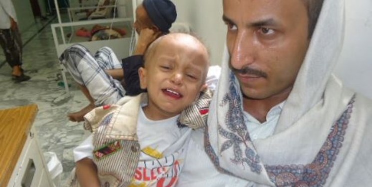جنایات ائتلاف سعودی علیه بیماران؛ ۳ هزار کودک سرطانی یمن، در معرض خطر مرگ قرار دارند