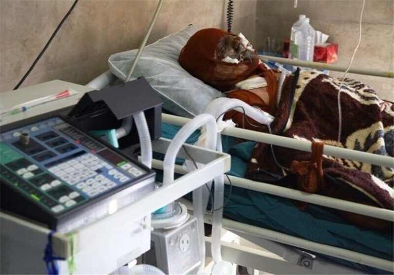 انجام ۹۰۰ عمل جراحی در بزرگترین مرکز سوختگی جنوب غرب کشور