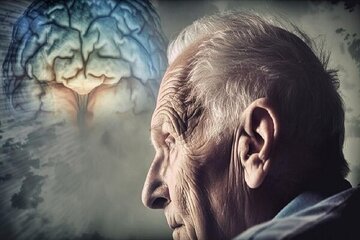 هوش مصنوعی یک علت جدید برای ابتلا آلزایمر کشف کرد