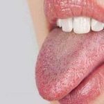 زبان سفید چه چیزی درباره سلامت می‌گوید؟
