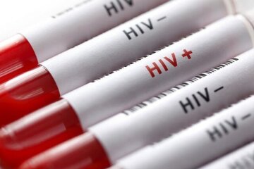 HPV از طریق استخر و سرویس بهداشتی منتقل می‌شود؟