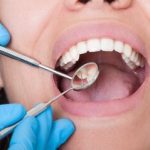 تأثیر استرس بر سلامت دهان و دندان