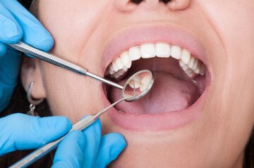 تأثیر استرس بر سلامت دهان و دندان