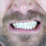 این میوه تهدید پنهان برای دندان‌ها است