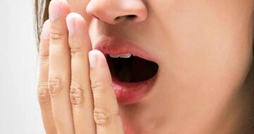 سفیدی روی زبان برای چیست؟/ روش رفع بوی بد دهان