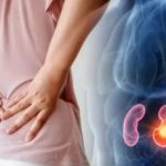 چه داروهایی برای کلیه پر خطر هستند؟