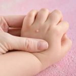 تفاوت خال گوشتی و زگیل چیست؟/ آیا کندن  زگیل با ناخنگیر یا بستن نخ خطرناک است؟