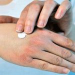راهکارهای ساده برای جلوگیری از خشکی پوست در پاییز