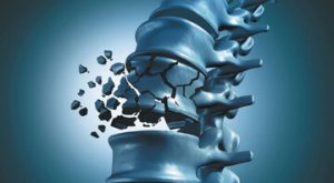 میوه‌ای که استخوان‌های‌تان را از پوک شدن نجات می‌دهد