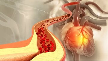 یک روش ساده برای کاهش کلسترول خون