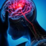 روزانه ۲۰۰ تهرانی دچار این عارضه میشوند