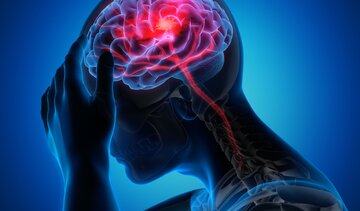 روزانه ۲۰۰ تهرانی دچار این عارضه میشوند