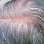 آیا می‌توان جلوی سفید شدن موها را گرفت؟/ دلیل سفیدی مو در نواحی شقیقه‌ها چیست؟/ چه دارو و مکملی اثر قطعی بر رفع سفیدی مو دارد؟