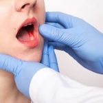 اصلی‌ترین عوامل خطر در سرطان دهان چیست؟/ علائم هشدار دهنده