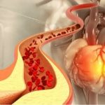 این ماده غذایی کلسترول خون را کاهش می‌دهد