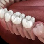 با خواندن این دلیل حتما سراغ مسواک و نخ دندان می‌روید