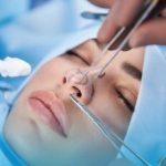 جراحی بینی بدون بیهوشی توسط دستیار دیپلمه پزشک