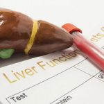 علت بالا رفتن آنزیم‌های کبدی چیست؟/ باید مراقب چه علائمی باشیم