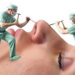 چرا شیادها در بازار جراحی زیبایی کاسبی شان پررونق است؟