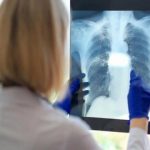 یک علت مهم و کمتر گفته شده درباره خستگی مزمن