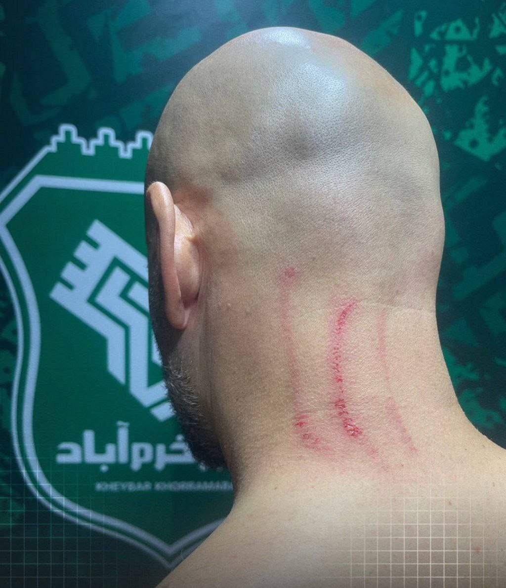 عکس| ادعای باشگاه استقلال: مربی ما را کتک زدند!