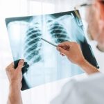 چرا آنفلوآنزا گاهی کشنده میشود؟