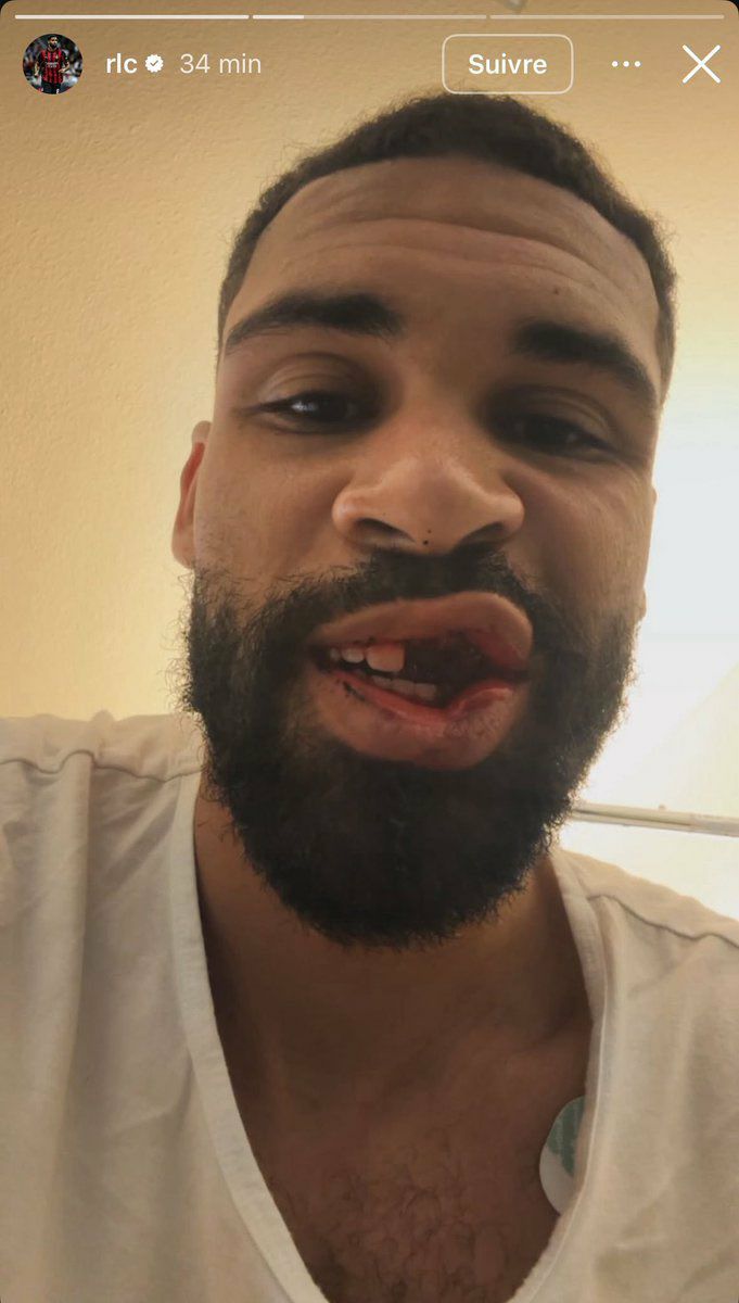 عکس| تصویر وحشتناک مصدومیت ستاره لیگ برتر