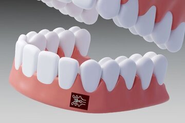 پایان معاینه صرف بصری؟ فناوری جدید برای رصد زودهنگام بیماری لثه